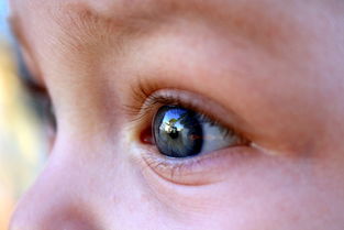 私人代生孩子眼睛好多眼屎